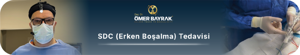 sdc tedaviisi