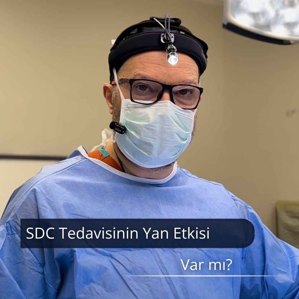 sdc tedavisi
